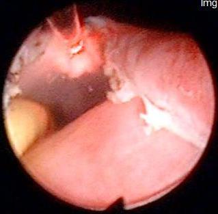Ectopic ureter kimba0009 Ectopic ureter kimba0009